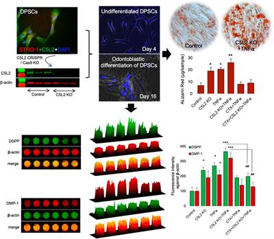 C5L2 CRISPR KO enhances dental pulp stem cell-mediated dentinogenesis via TrkB under TNFα-induced inflammation